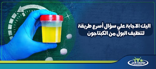 أسرع طريقة لتنظيف البول من الكبتاجون
